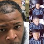 Hair growth  Treatment