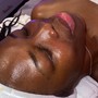 Dermaplaning Facial