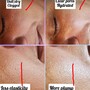 Polishing Peel