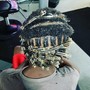 Scalp Treatment