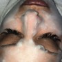 Deluxe facial W/Acne Treatment