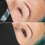 Lash removal