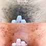 Men’s Brazilian Wax