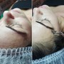 Lash removal