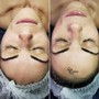 Lash removal