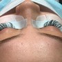 Eyelash Extension Removal