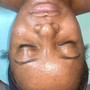 Acne Facial Treatment