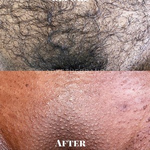 Forventning fordom Hver uge Brazilian Wax Near Me: York, PA | Appointments | StyleSeat