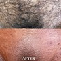 Men’s Brazilian Wax