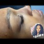 Eyelash Extension Removal