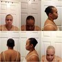 Alopecia Relaxer