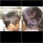 Alopecia Scalp Treatment