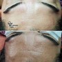 Men's Back Wax