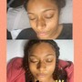 Eyelash Extension Removal