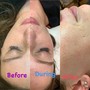 Intro Facial