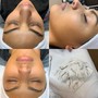 Dermaplane Facial