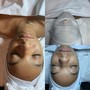 Dermaplane Facial