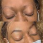 Brow Enhancement