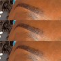 Brow Enhancement