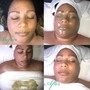 Revitalizing Facial