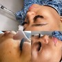 Eyelash Extension Removal