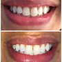 TEETH WHITENING MASTERCLASS