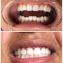 TEETH WHITENING MASTERCLASS