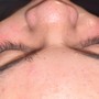 Eyelash Extension Removal