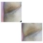 Underarm Wax