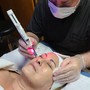 Oxygen Facial