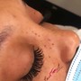 Eyelash Extension Removal