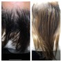 Medical Hair Restoration package of 5 sessions