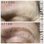 DERMALPLANING + MICRODERMABRASION COMBO FACIAL