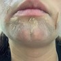 Chin Wax