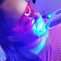 Teeth Whitening