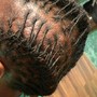 Scalp Treatment