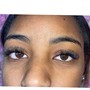 Eyelash Extension Removal