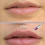 4-6 Week Lip Blush Touch Ups