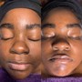 Back Facial and basic facial