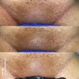 Men’s Brazilian Wax