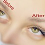 Eyelash Extension Removal