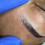 Scalp Micropigmentation