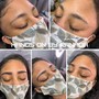 Facial