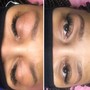 Eyelash Extension Removal