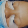 Facial