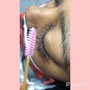 Add on Ingrown Hair Removal