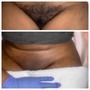 Women Brazilian Wax