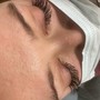 Eyelash Extension Removal