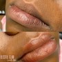 Lip Neutralization