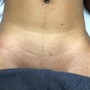 Vajacial, Brazilian Wax